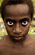 Image result for Person with Big Eyes