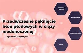 Image result for co_to_za_zespół_błon_szklistych