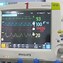 Image result for Philips Patient Monitor