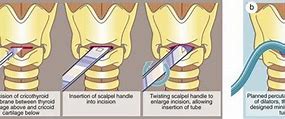 Image result for acatal�crico