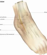 Image result for Right Distal Circumference Foot