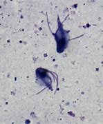 Image result for Trichomonas Foetus