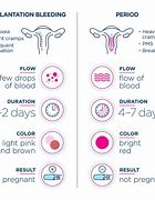 Image result for What Does Pregnancy Bleeding Look Like