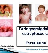 Image result for estreptocovia
