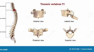 Image result for T1 Vertebrae Anatomy