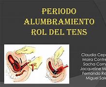 Image result for alumbeamiento