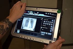 Image result for All Stat Portable X-ray