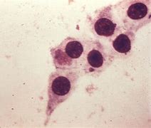 Image result for Chlamydia Trachomatis Microscopy