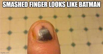 Image result for Smashed Finger Meme