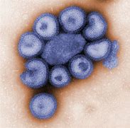 Image result for Virus Influenza H5N1 Under Microscope
