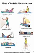 Image result for Torn Meniscus Physical Therapy Exercises