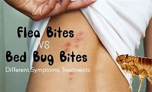 Image result for What Do Flea Bites Bed Bug Look Like