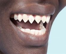 Image result for Sharp Teeth