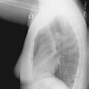 Image result for radiographic