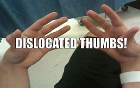Image result for Dislocating Thumb Meme