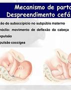Image result for hipomoclio