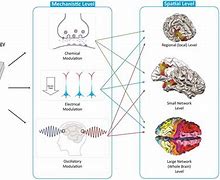 Image result for Electric Brain Stimulation