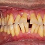Image result for Mouth with Sharp Teeth
