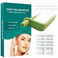 Image result for Skin Tag Rubber Band Remover