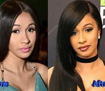 Image result for Cardi B Body Surgery