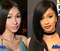 Image result for Cardi B S Face Surgery