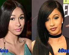 Image result for Cardi BS Body Before Surgery
