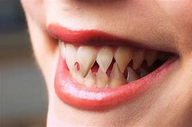 Image result for Woman with Sharp Teeth
