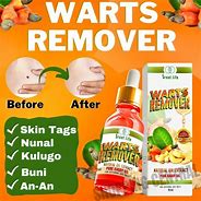 Image result for Molluscum Wart Remover
