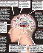 Image result for Male Female Brain Hemispheres