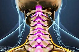 Image result for Cervical Spine Nerve Pain
