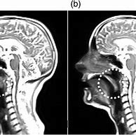 Image result for IPA Vowels MRI