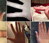 Image result for Smartphone Pinky Syndrome Meme