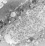 Image result for Molluscum Contagiosum Virus Structure