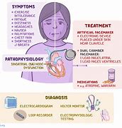 Image result for Myocardial Injury Types