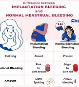 Image result for Implantation Bleeding What Does It Look Like