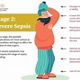Image result for Sepsis Stages
