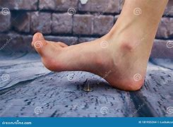 Image result for Sharp Tack in Foot