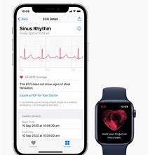 Image result for Apple Watch ECG Examples
