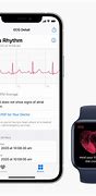 Image result for ECG Monitor Apple Watch
