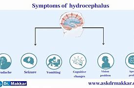 Image result for Normotensive Hydrocephalus Signs