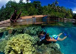 Image result for Microcephaly Solomon Islands
