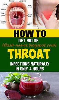 Image result for Itchy Throat Allergy