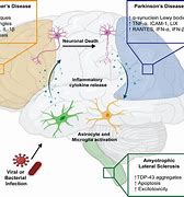 Image result for Brain Problems