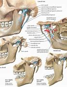 Image result for Jawbone Anatomy