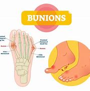 Image result for B Union On Foot