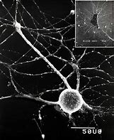 Image result for Efferent Neuron Under Microscope