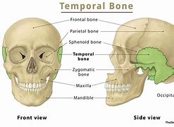 Image result for Temporal Bone