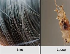 Image result for What Does Lice Look Like On a Comb