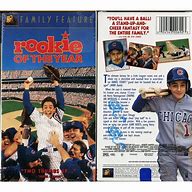 Image result for Rookie of the Year Movie Broken Arm Pics