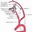 Image result for carotid artery anatomy